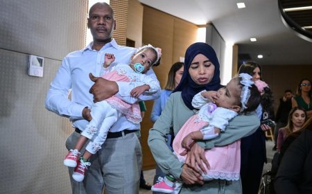 Cezayirli yapışık ikizlere umut ışığı Türkiye'de doğdu