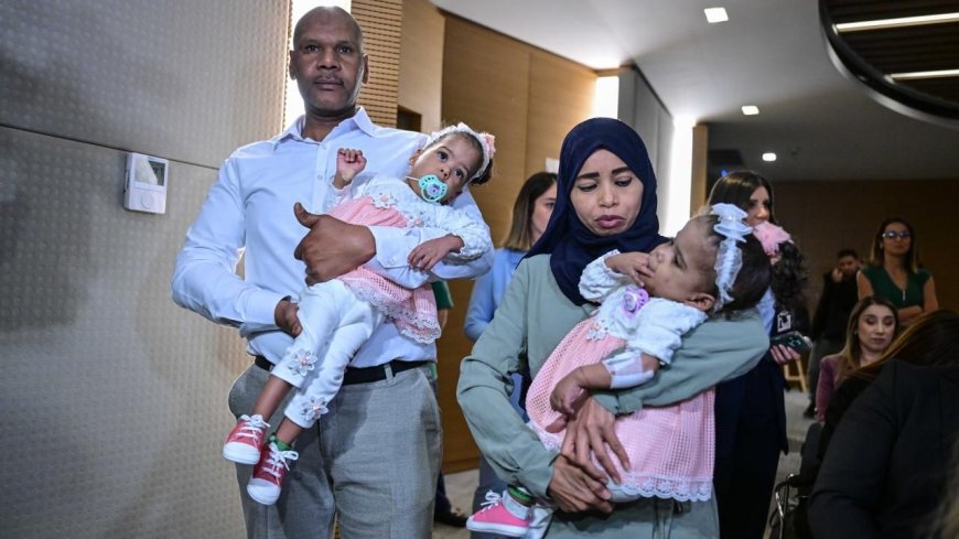 Cezayirli yapışık ikizlere umut ışığı Türkiye'de doğdu